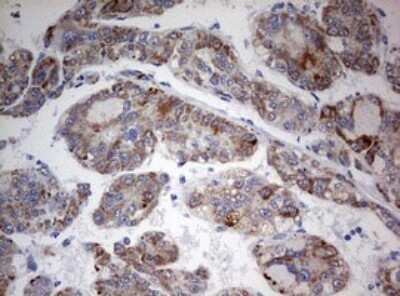 Immunohistochemistry: FEN-1 Antibody (OTI1F3) - Azide and BSA Free [NBP2-70716]