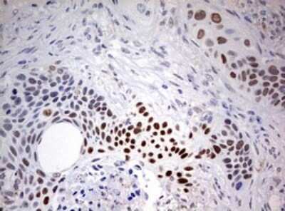 Immunohistochemistry: FEN-1 Antibody (OTI1F3) - Azide and BSA Free [NBP2-70716]