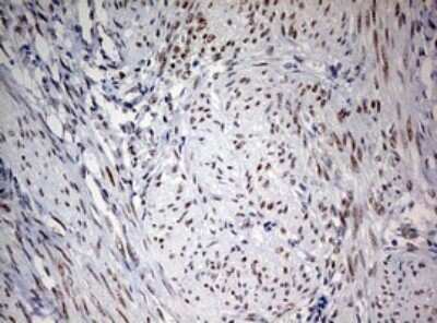 Immunohistochemistry: FEN-1 Antibody (OTI1F3) - Azide and BSA Free [NBP2-70716]