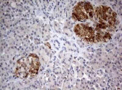 Immunohistochemistry: FEN-1 Antibody (OTI1F3) - Azide and BSA Free [NBP2-70716]