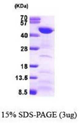 SDS-PAGE: Recombinant Human FEN-1 Protein [NBP1-30306]