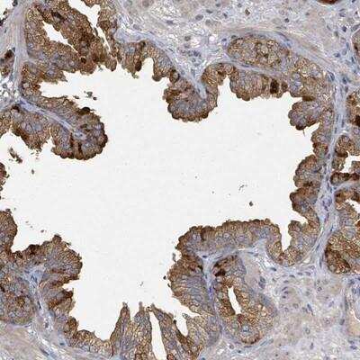 Immunohistochemistry-Paraffin: FENS1 Antibody [NBP2-13521]