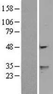 Western Blot: FENS1 Overexpression Lysate [NBL1-17788]