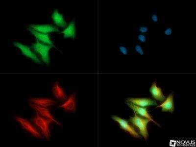 Immunocytochemistry/ Immunofluorescence: Fer Antibody - BSA Free [NBP1-20089]