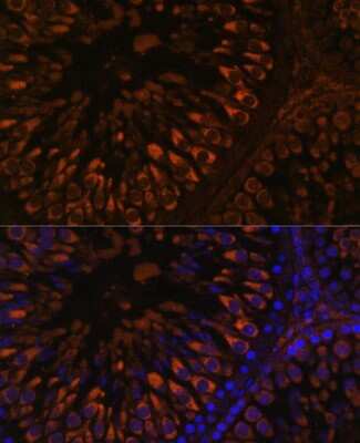 Immunohistochemistry: FER1L5 Antibody - Azide and BSA Free [NBP3-05642]