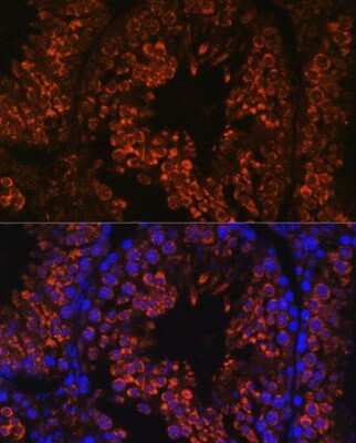 Immunohistochemistry: FER1L5 Antibody - Azide and BSA Free [NBP3-05642]