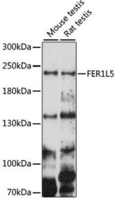 Western Blot: FER1L5 AntibodyAzide and BSA Free [NBP3-05642]