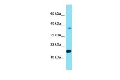 Western Blot: FER1L6-AS2 Antibody [NBP3-09656]