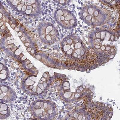 Immunohistochemistry-Paraffin: FERD3L Antibody [NBP1-91897]