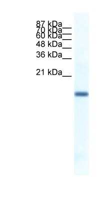 Western Blot: FERD3L Antibody [NBP1-80168]