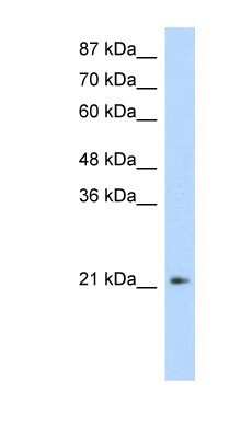 Western Blot: FERD3L Antibody [NBP1-80169]