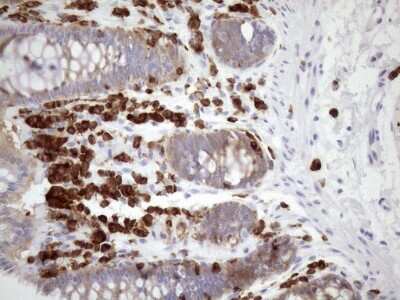Immunohistochemistry: FERMT3/URP2 Antibody (OTI3C7) [NBP2-45641]