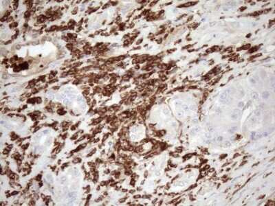 Immunohistochemistry: FERMT3/URP2 Antibody (OTI3C7) [NBP2-45641]