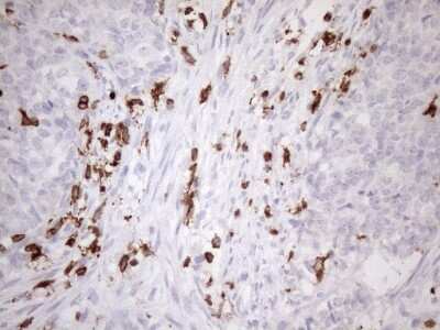 Immunohistochemistry: FERMT3/URP2 Antibody (OTI3C7) [NBP2-45641]