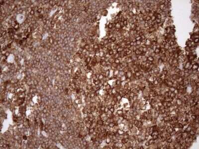 Immunohistochemistry: FERMT3/URP2 Antibody (OTI3C7) [NBP2-45641]