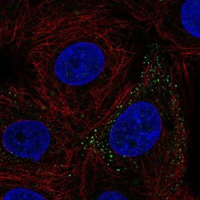 Immunocytochemistry/ Immunofluorescence: FERMT3/URP2 Antibody [NBP2-57110]