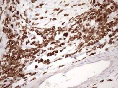 Immunohistochemistry: FERMT3/URP2 Antibody (OTI3C7) - Azide and BSA Free [NBP2-72241]