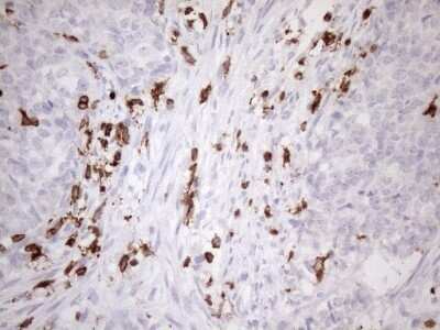 Immunohistochemistry: FERMT3/URP2 Antibody (OTI3C7) - Azide and BSA Free [NBP2-72241]