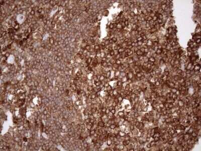 Immunohistochemistry: FERMT3/URP2 Antibody (OTI3C7) - Azide and BSA Free [NBP2-72241]