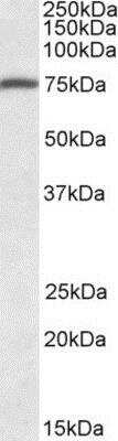 Western Blot: FERMT3/URP2 Antibody [NBP1-51974]