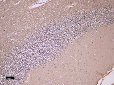 Immunohistochemistry-Paraffin: FEZ1 Antibody [NB100-53816]