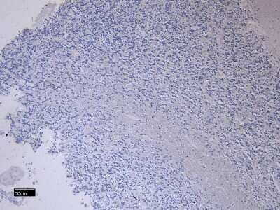 Immunohistochemistry-Paraffin: FEZ1 Antibody [NB100-53816]