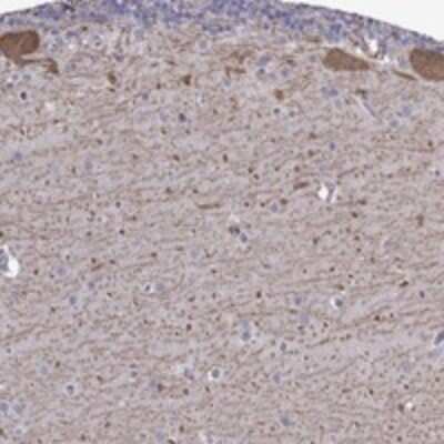 Immunohistochemistry-Paraffin: FEZ1 Antibody [NBP3-17847]