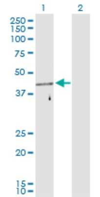 Western Blot: FEZ1 Antibody [H00009638-D01P]