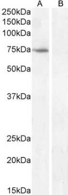 Western Blot: FEZ1 Antibody [NB100-53816]