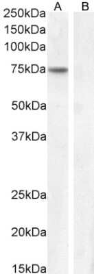 Western Blot: FEZ1 Antibody [NB100-53816]