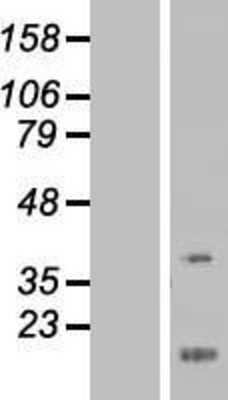 Western Blot: FEZ1 Overexpression Lysate [NBP2-06428]