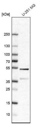 Western Blot: FEZ2 Antibody [NBP1-90909]