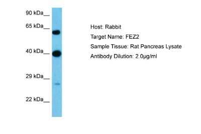 Western Blot: FEZ2 Antibody [NBP2-82776]