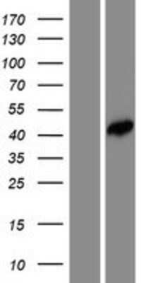 Western Blot: FEZ2 Overexpression Lysate [NBP2-08385]