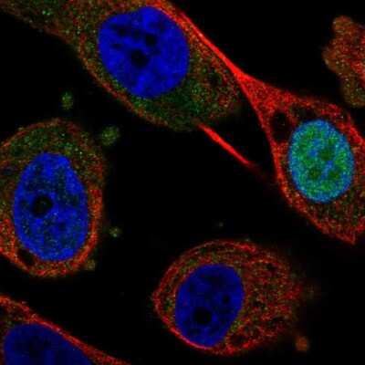 Immunocytochemistry/ Immunofluorescence: FEZF1 Antibody [NBP2-56611]