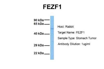 Western Blot: FEZF1 Antibody [NBP1-91367]