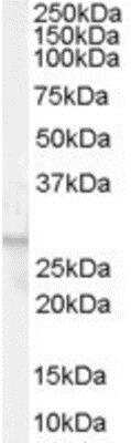 Western Blot: FFAR1/GPR40 Antibody [NB100-1537]