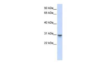 Western Blot: FFAR1/GPR40 Antibody [NBP2-88644]