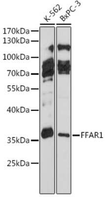 Western Blot: FFAR1/GPR40 AntibodyAzide and BSA Free [NBP3-02971]