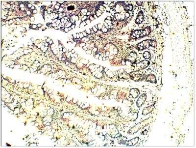 Immunohistochemistry-Paraffin: FFAR2/GPR43 Antibody [NBP3-12191]