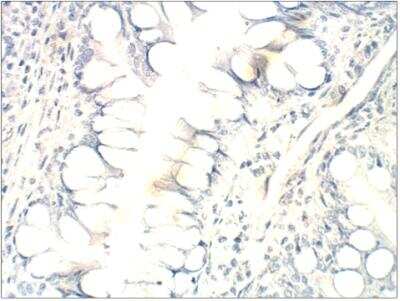 Immunohistochemistry-Paraffin: FFAR2/GPR43 Antibody [NBP3-12191]