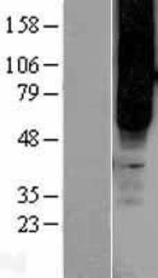 Western Blot: FFAR2/GPR43 Overexpression Lysate [NBL1-10682]