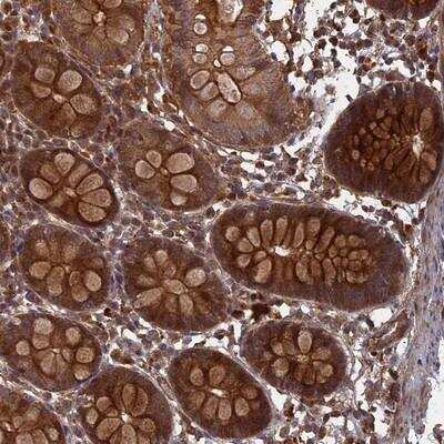 Immunohistochemistry: FFAR4/GPR120 Antibody [NBP1-89739]