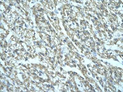 Immunohistochemistry: FGD1 Antibody [NBP1-79979]
