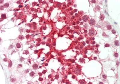 Immunohistochemistry-Paraffin: FGD1 Antibody [NBP1-79979]