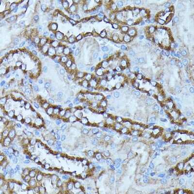 Immunohistochemistry-Paraffin: FGD1 Antibody - Azide and BSA Free [NBP3-03966]