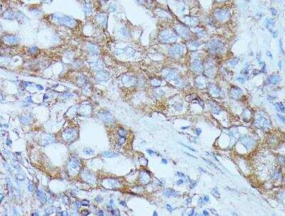 Immunohistochemistry-Paraffin: FGD1 Antibody - Azide and BSA Free [NBP3-03966]