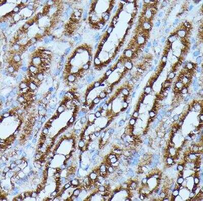 Immunohistochemistry-Paraffin: FGD1 Antibody - Azide and BSA Free [NBP3-03966]