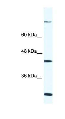 Western Blot: FGD1 Antibody [NBP1-79979]