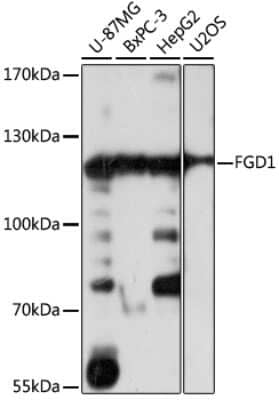 Western Blot: FGD1 AntibodyAzide and BSA Free [NBP3-03966]